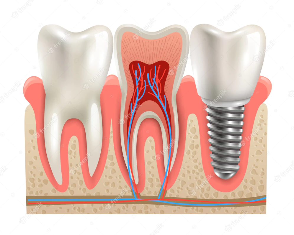 canal do dente