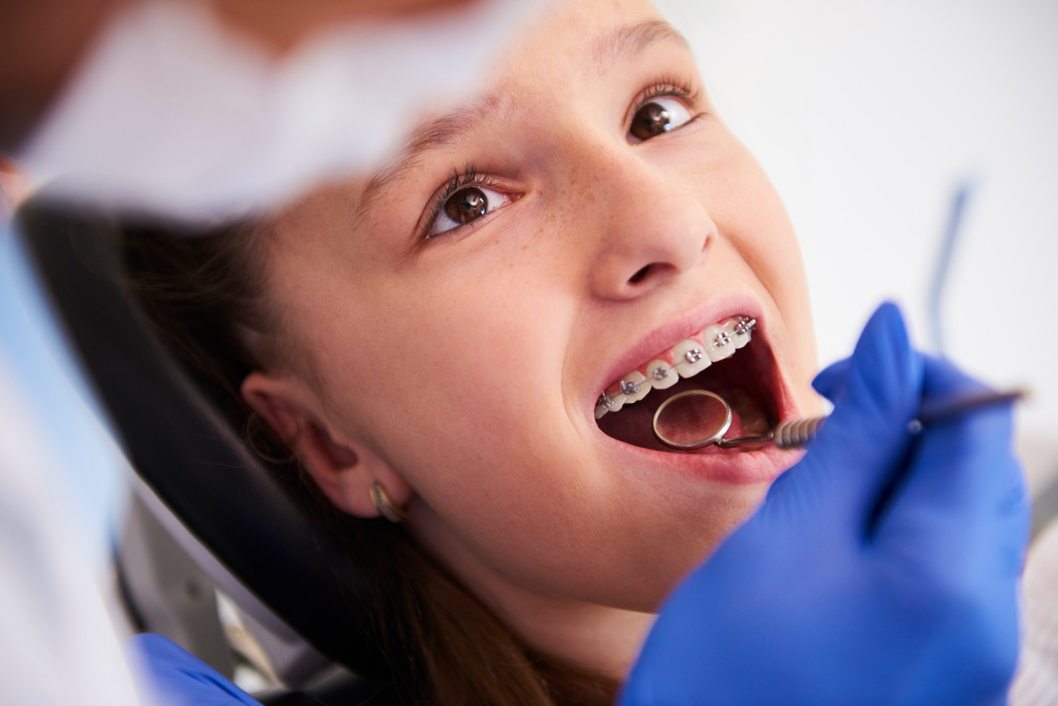 Aparelho Dentário
