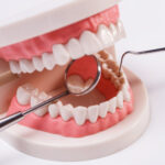 implante dentário