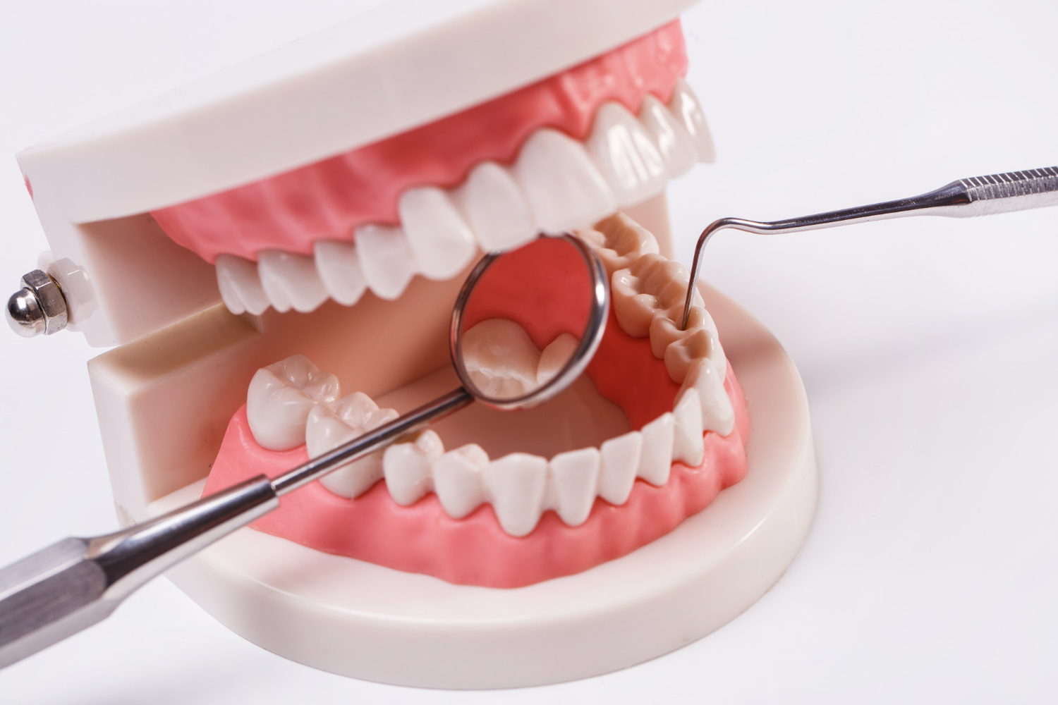 implante dentário
